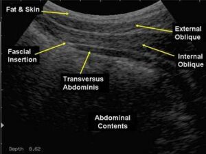 Real-time-ultrasound-physiotherapy - PhysioWorks!