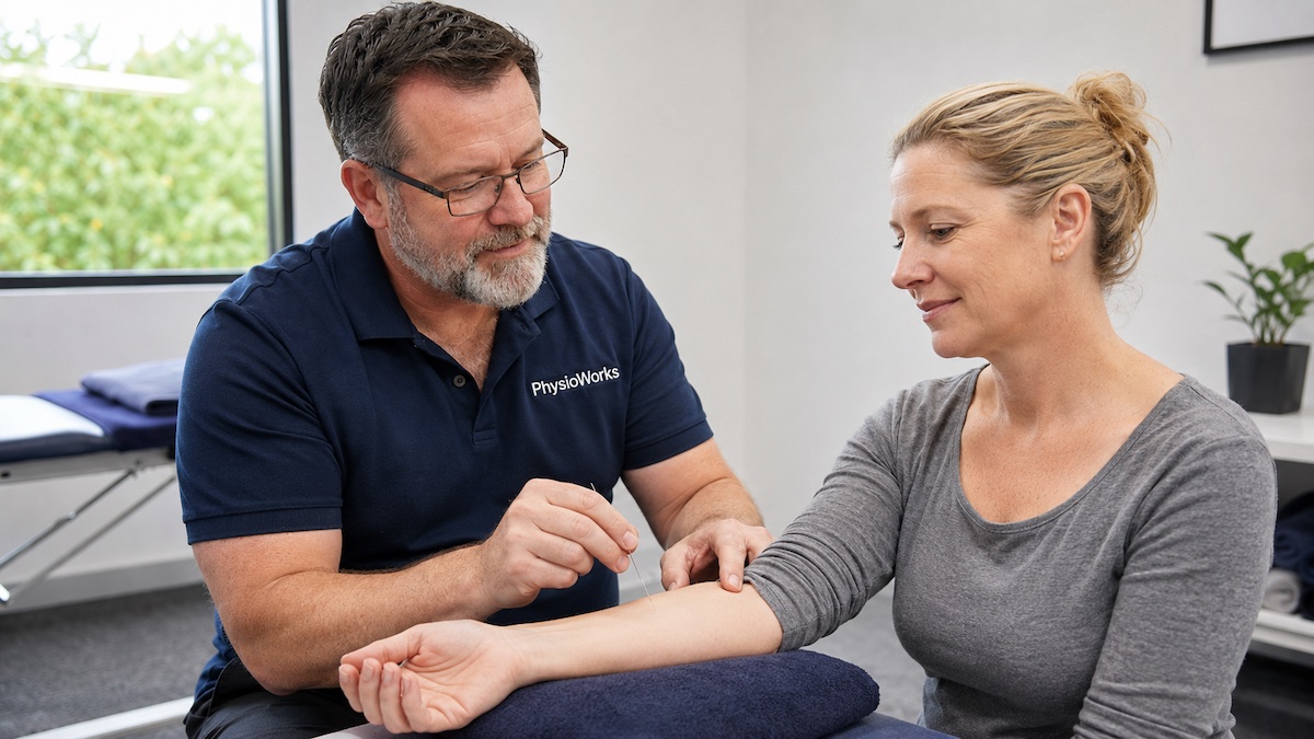 Acupuncture forearm point demonstration with fine sterile needle