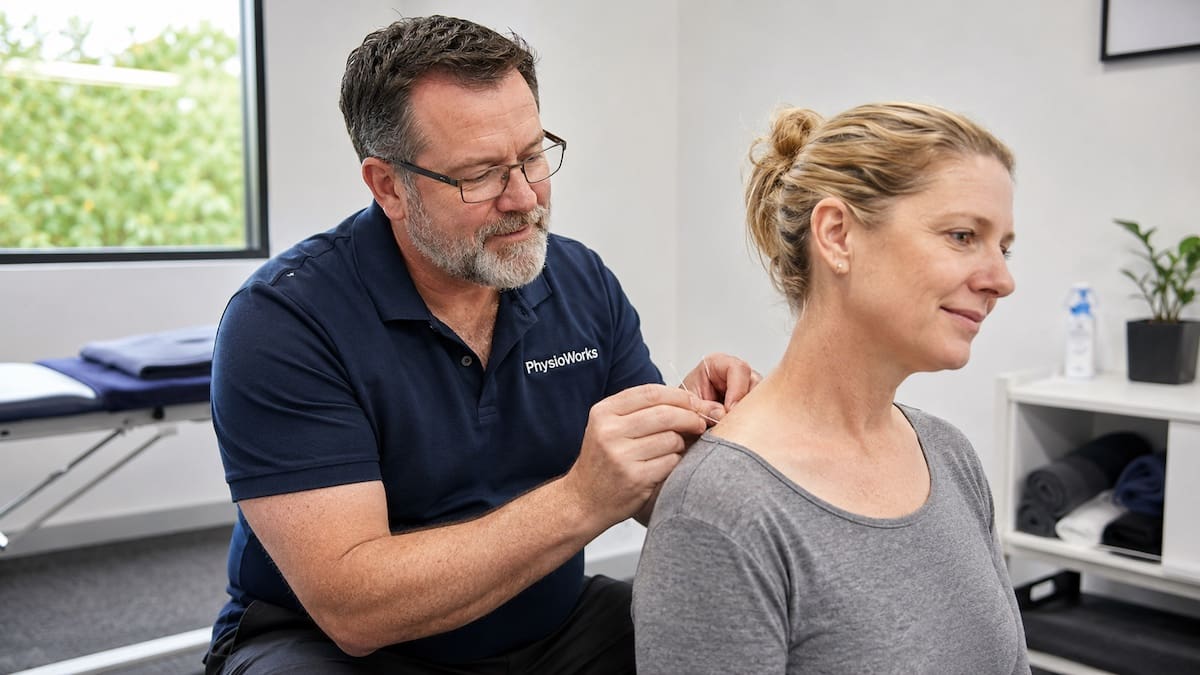 What is acupuncture upper trapezius needling in physiotherapy clinic