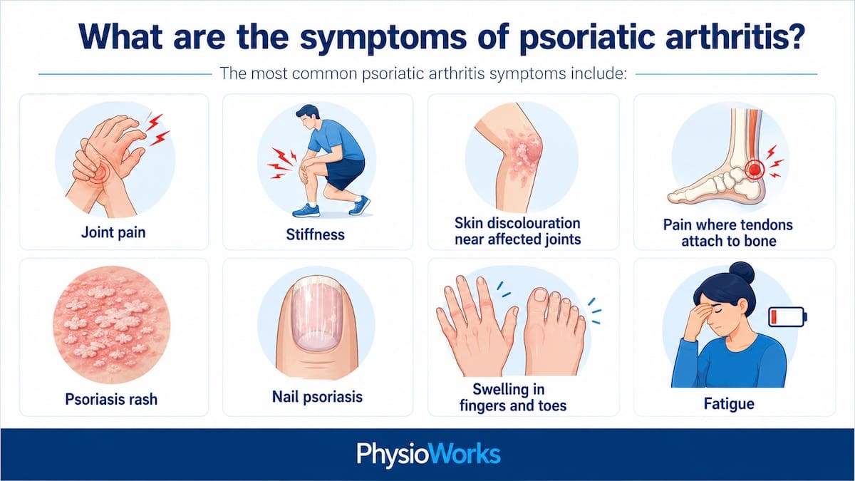 Psoriatic arthritis symptom areas including joints, heel, spine, skin and nails